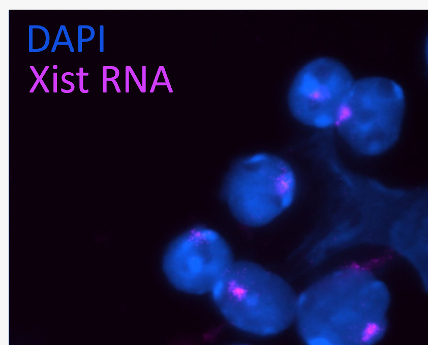 Una técnica brillante llamada FISH (pero no de pescado)